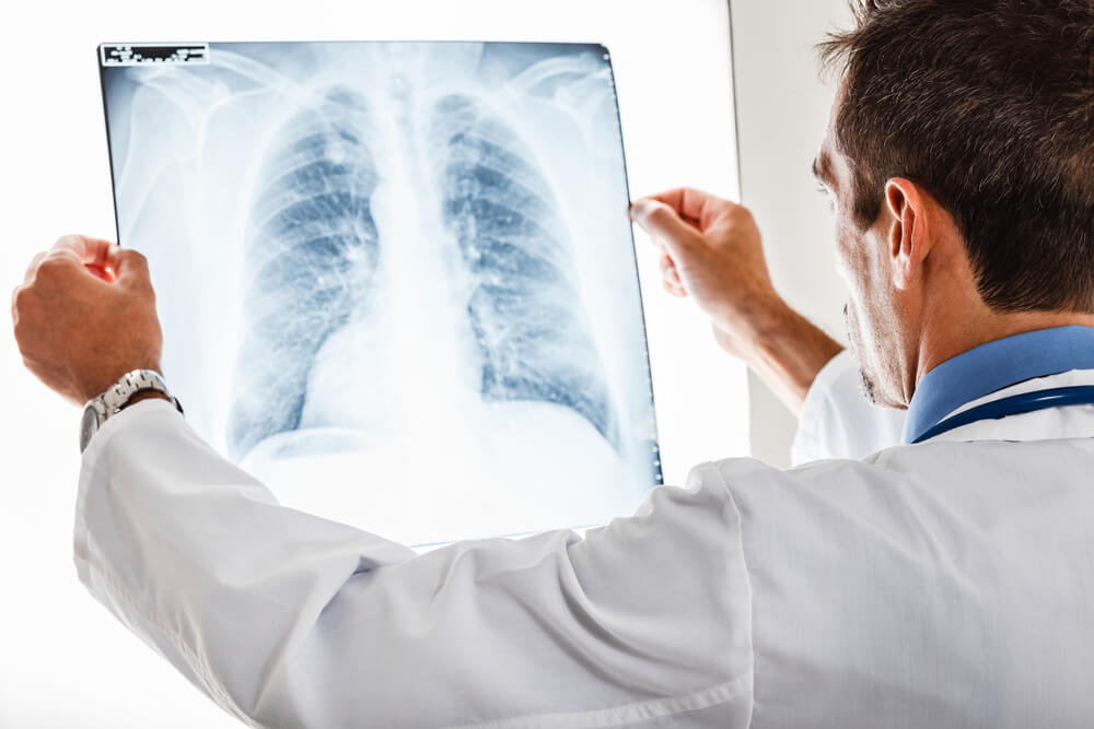 doctor with a picture of the lungs and chest