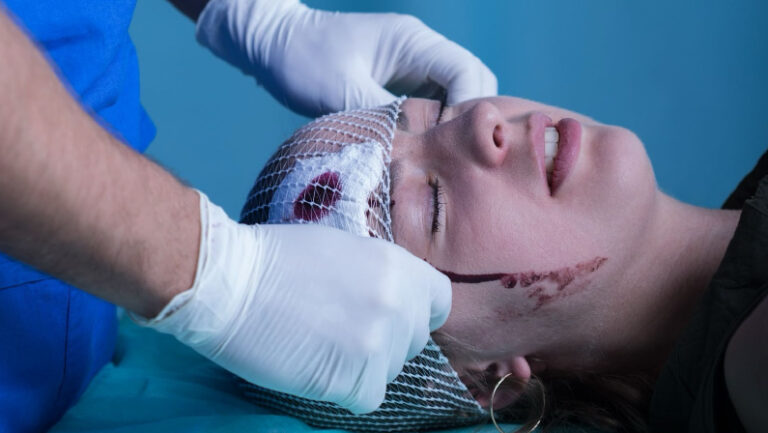 Can a Head Injury Cause Dementia? Understanding Risks and Preventive Measures