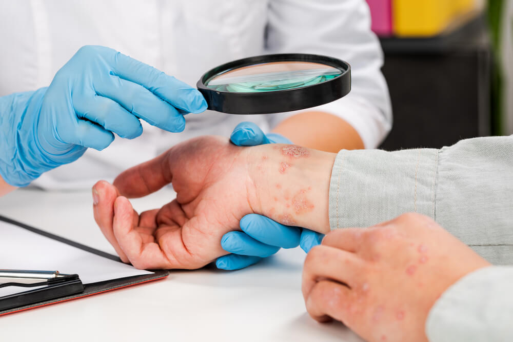 A dermatologist wearing gloves examines the skin of a sick patient. Examination and diagnosis of skin diseases-allergies, psoriasis, eczema, dermatitis.