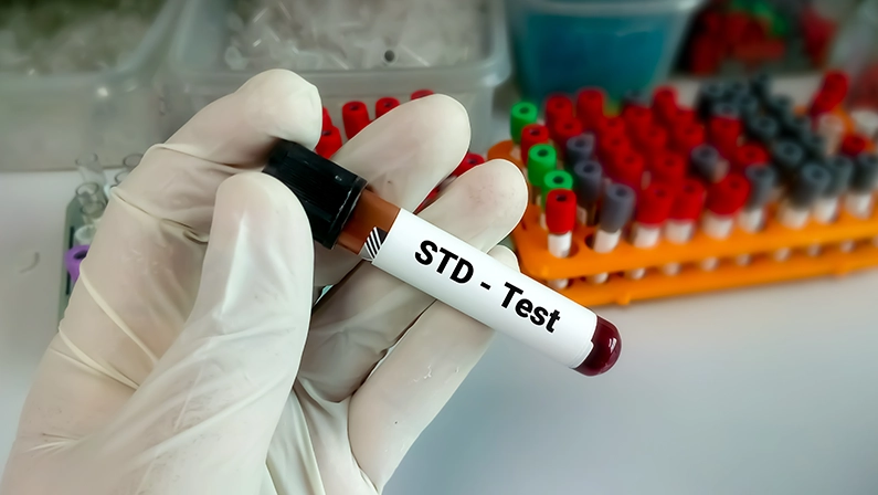 std test