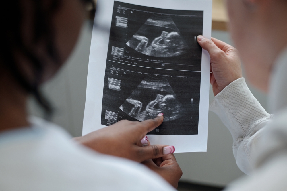 Healthcare professional holding and showing ultrasound images during prenatal checkup