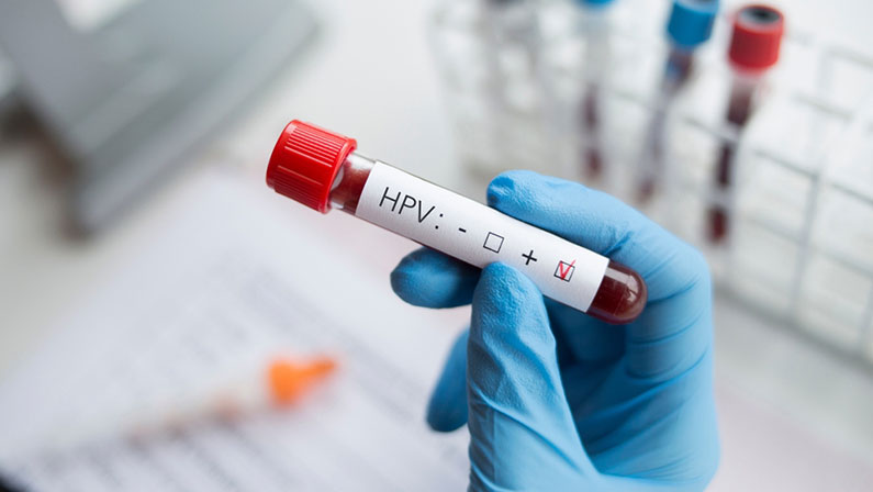 Laboratory - blood sample positive with HPV (human papilloma virus) deficiency test