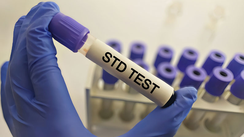 Sexually Transmitted Disease (STD) Test There are a variety of blood Test used to detect the presence of STDs, including HIV, syphilis, and hepatitis B and C.
