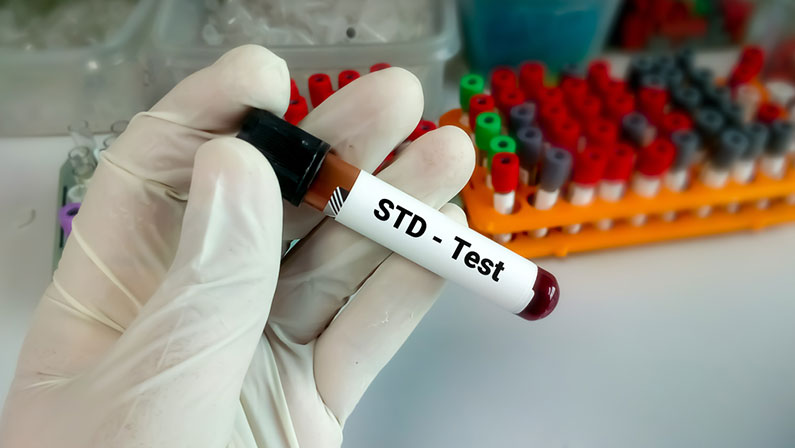 Blood sample for STD test, sexual transmitted diseases diagnosis medical and healthcare concept.