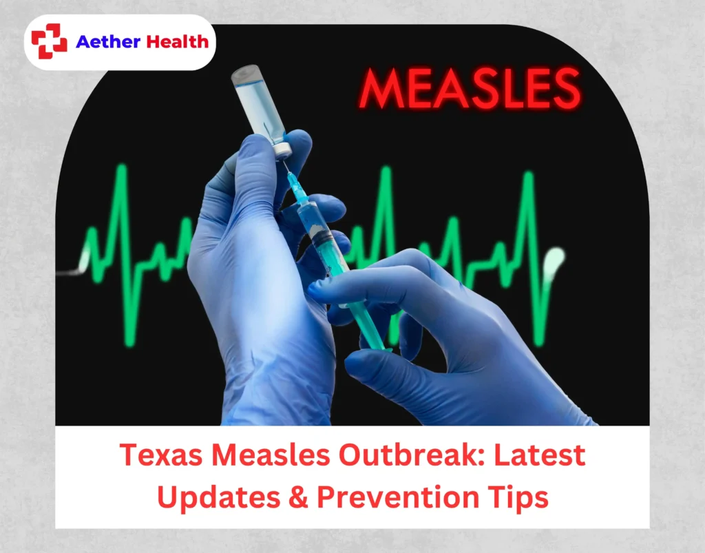 Texas Measles Outbreak Latest Updates & Prevention Tips