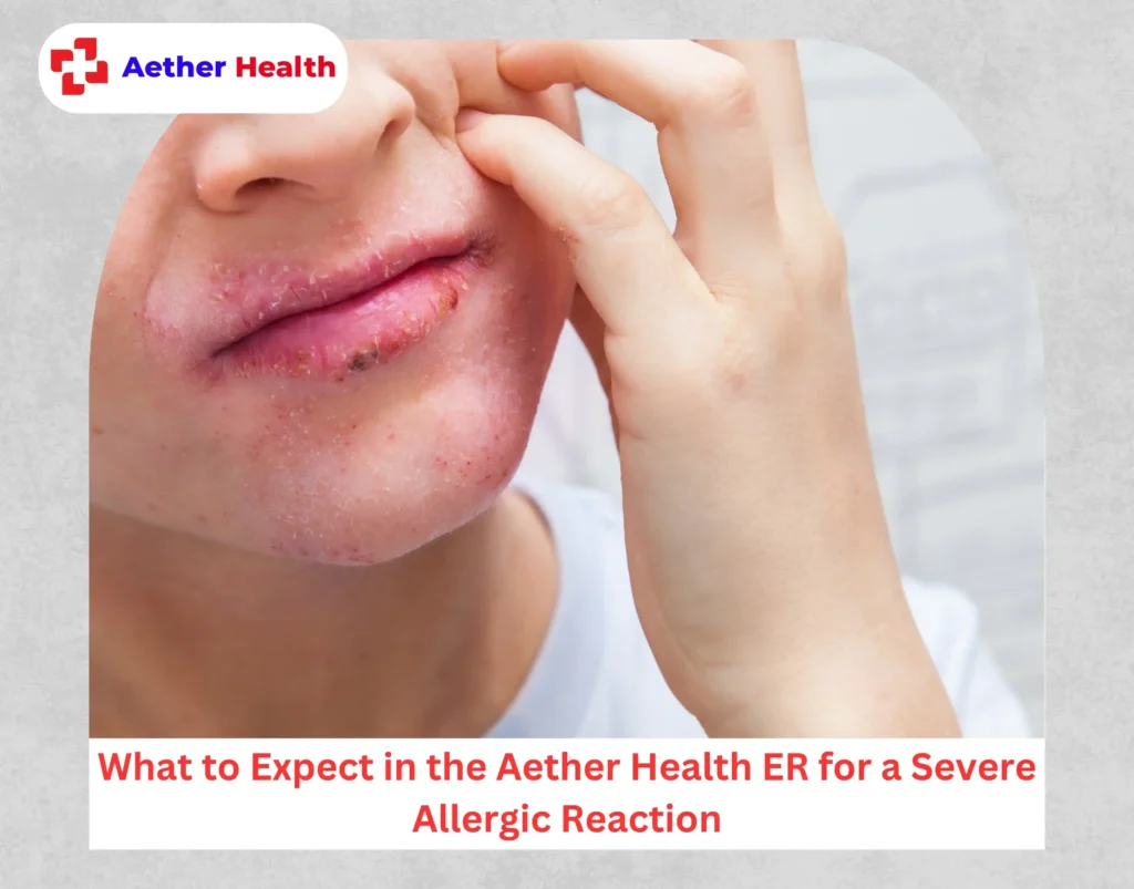 Severe Allergic Reaction Or Anaphylaxis
