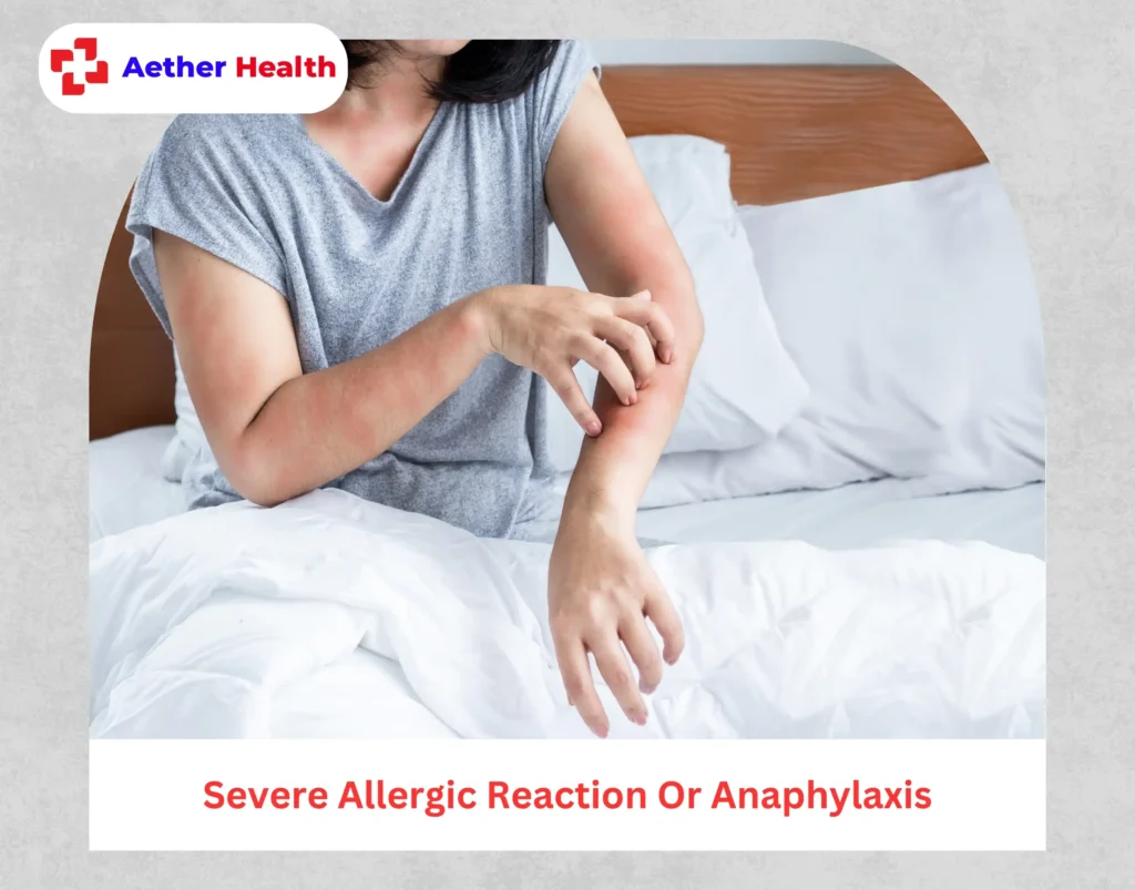 What to Expect in the Aether Health ER for a Severe Allergic Reaction