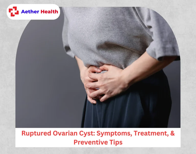 Ruptured Ovarian Cyst Symptoms, Treatment, & Preventive Tips
