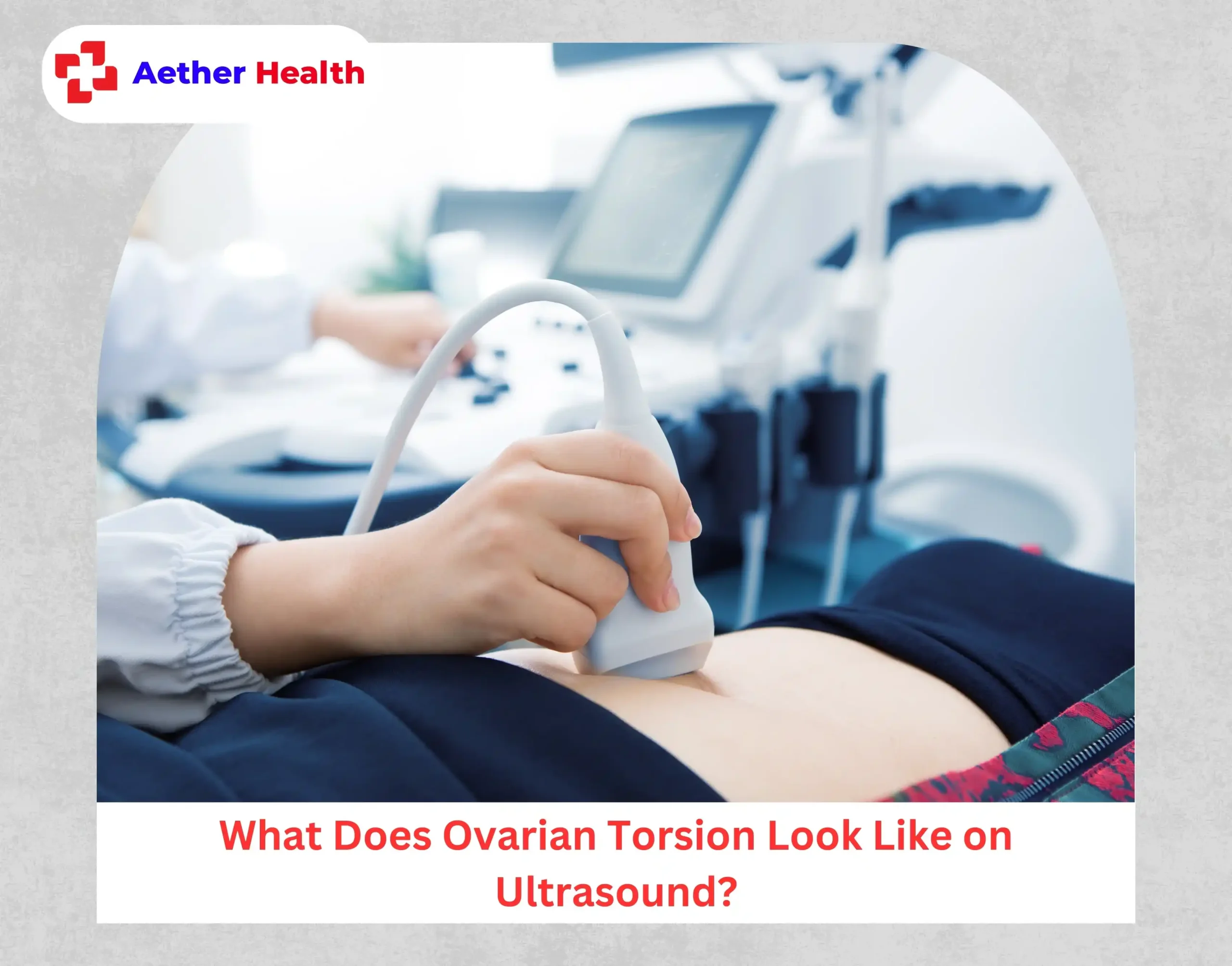 What Does Ovarian Torsion Look Like on Ultrasound