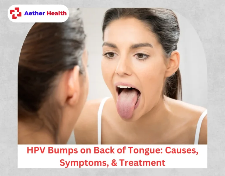 HPV Bumps on Back of Tongue Causes, Symptoms, & Treatment