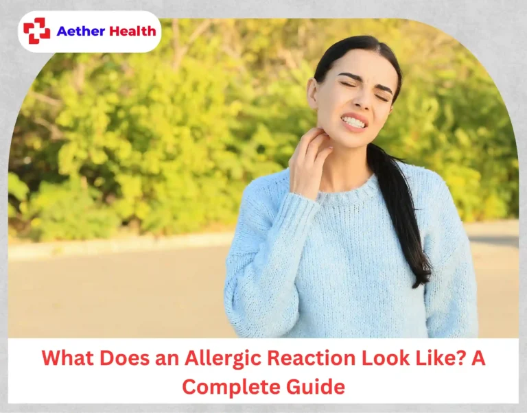 What Does an Allergic Reaction Look Like A Complete Guide