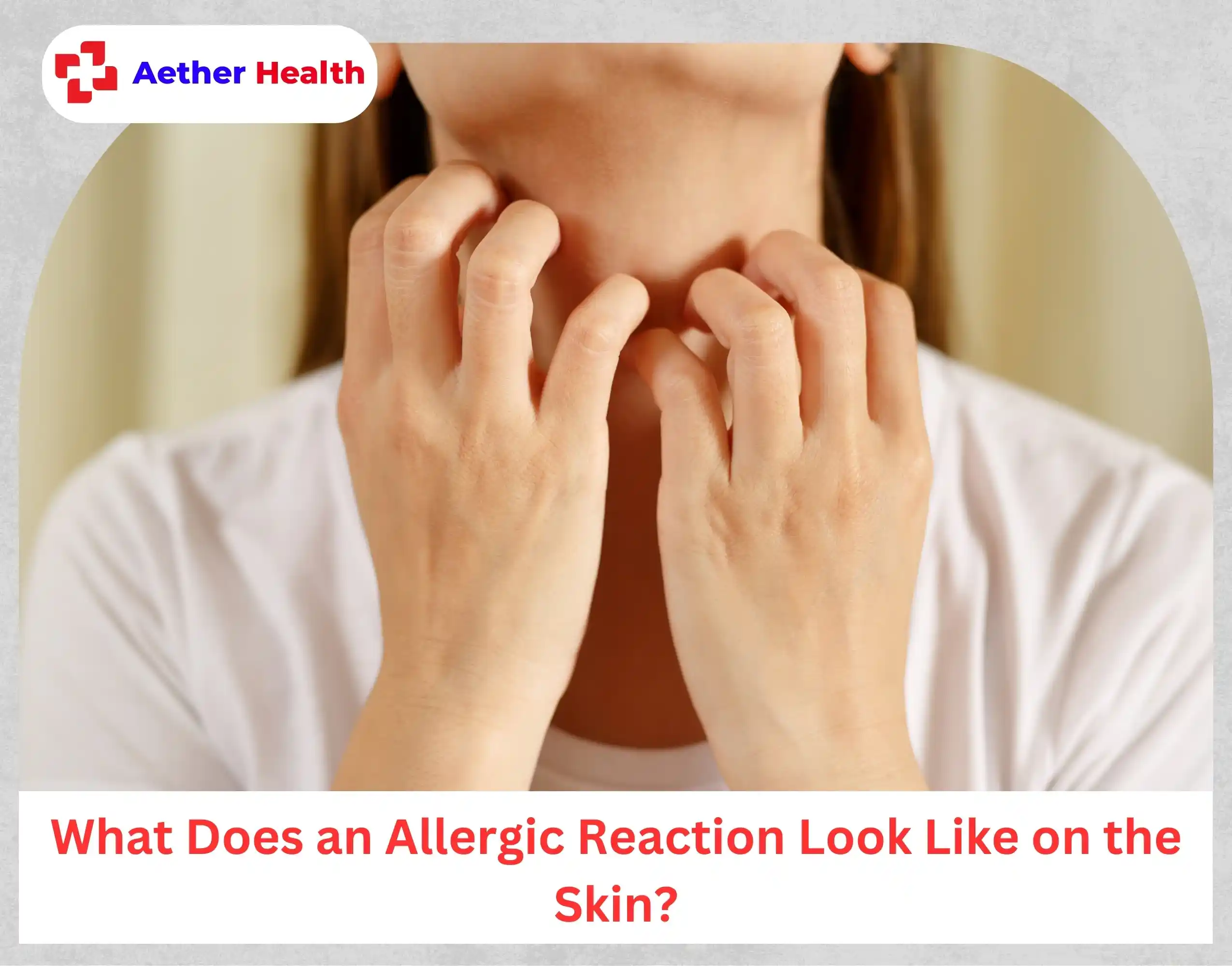 What Does an Allergic Reaction Look Like on the Skin