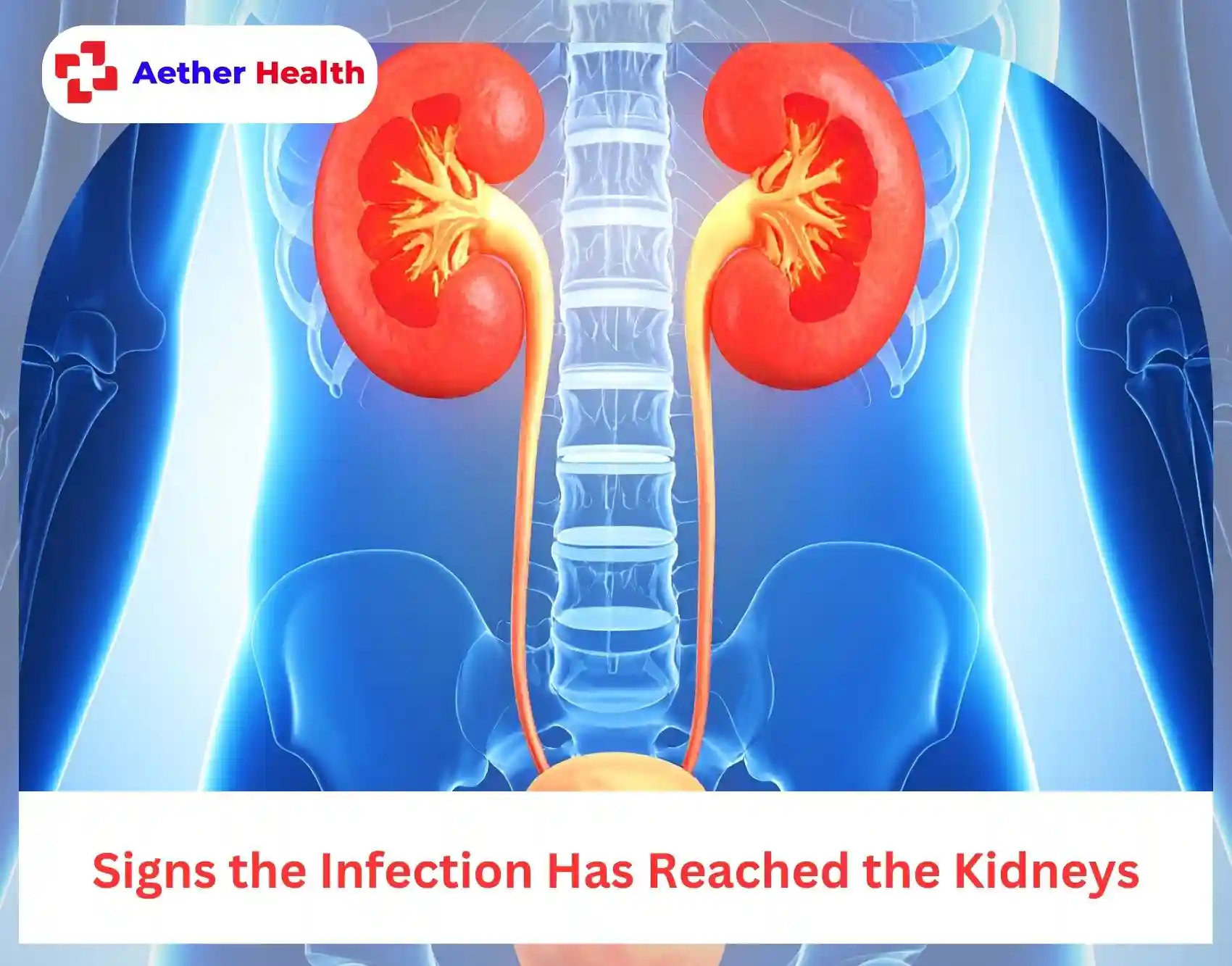 kidney infection warning signs Aether Health ER