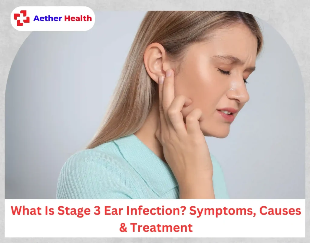 What Is Stage 3 Ear Infection Symptoms, Causes & Treatment