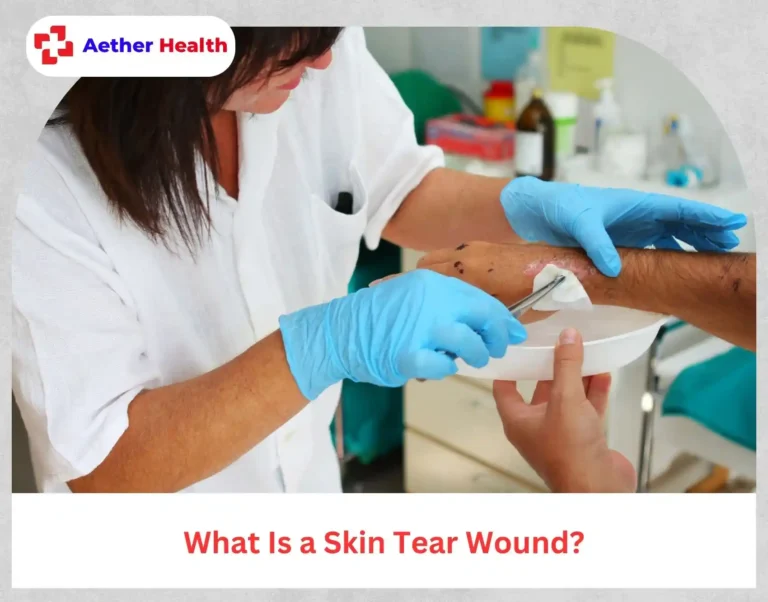 skin tear wound diagram Aether Health ER