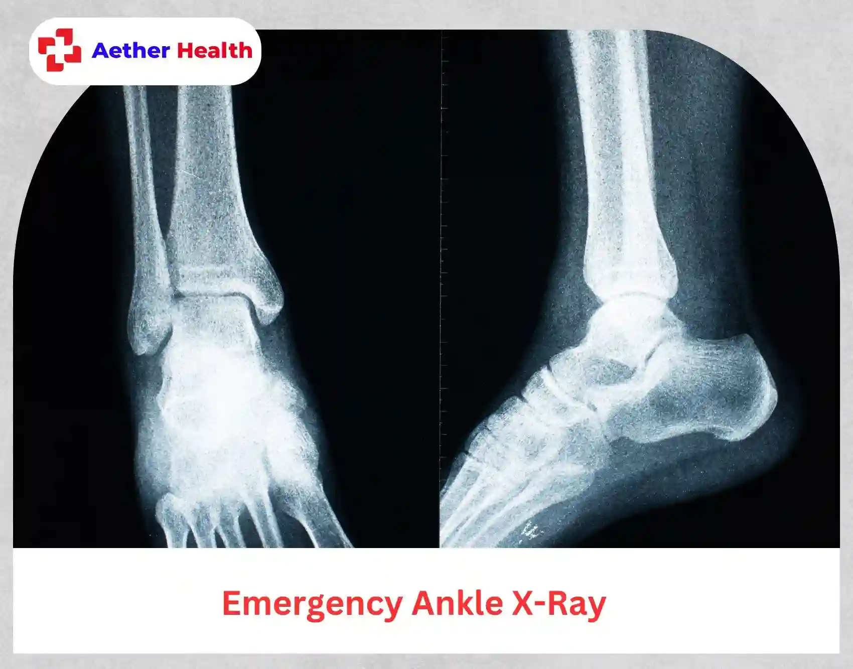emergency ankle X-ray Aether Health Texas
