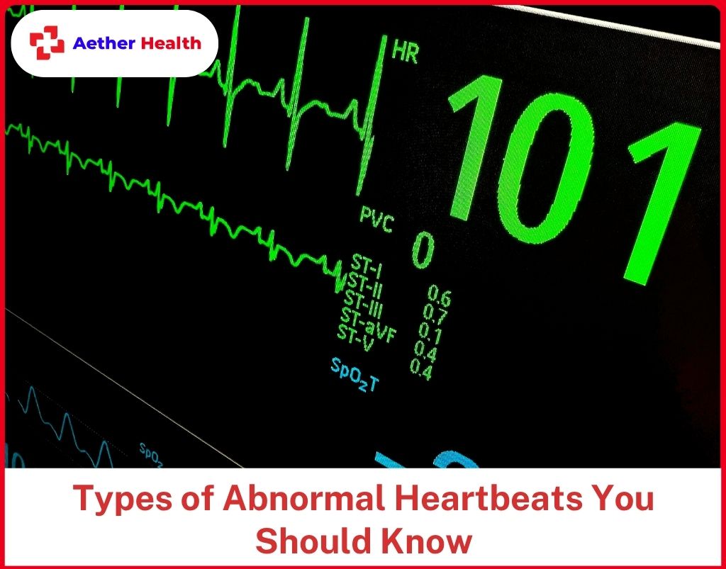 Types of Abnormal Heartbeats You Should Know