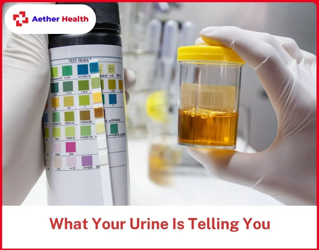 What Your Urine Is Telling You
