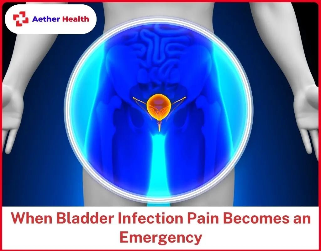 When Bladder Infection Pain Becomes an Emergency