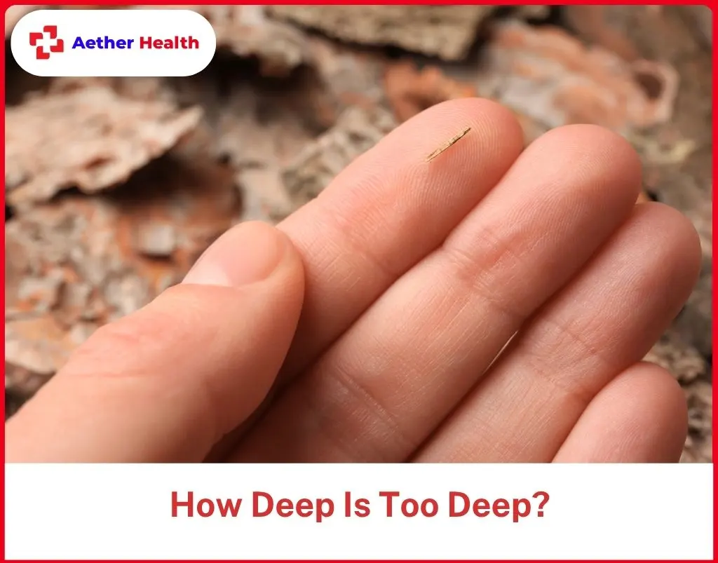 How Deep Is Too Deep