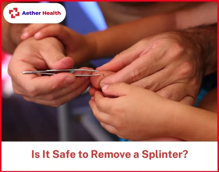 Is It Safe to Remove a Splinter